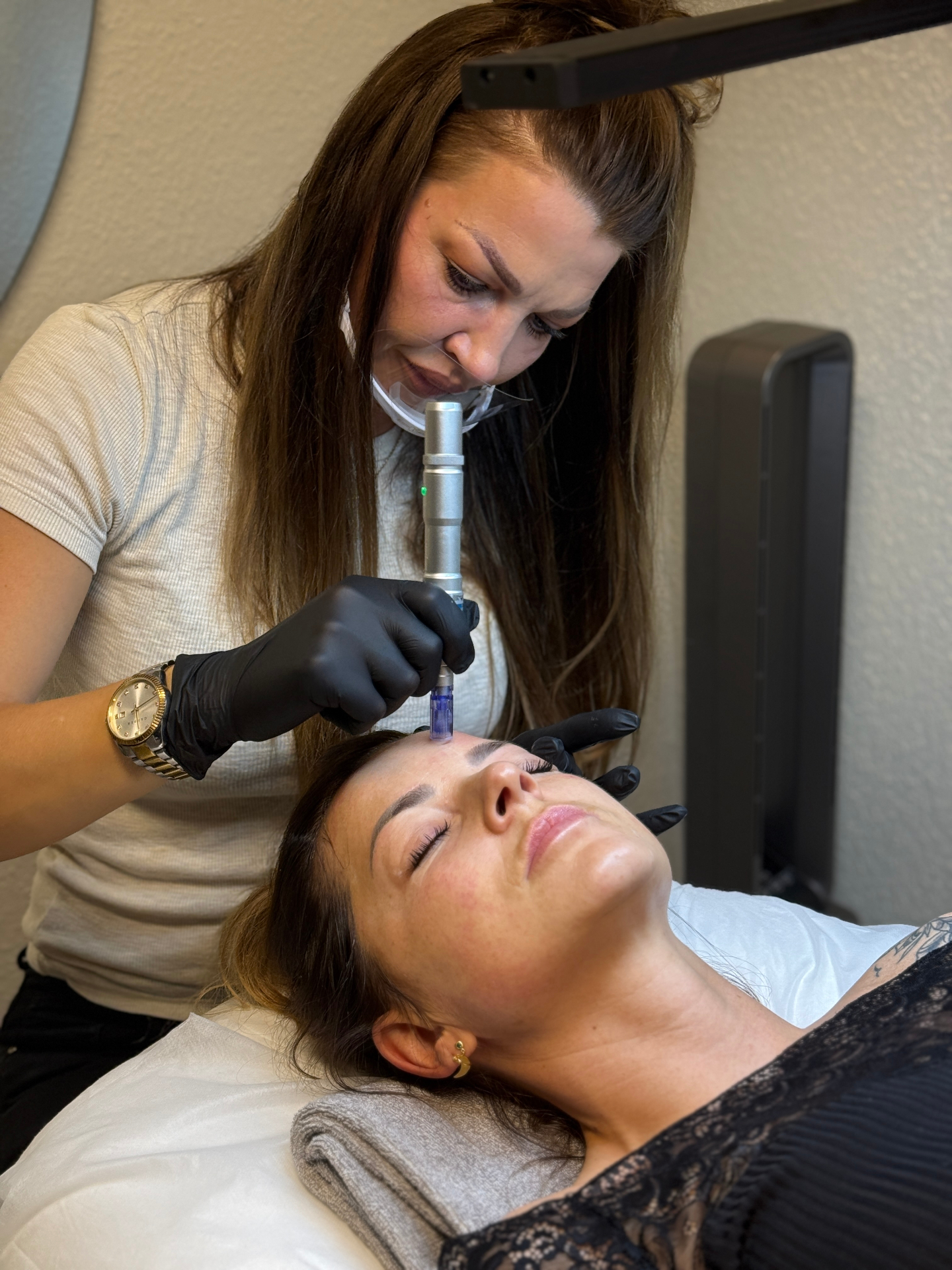 Microneedling